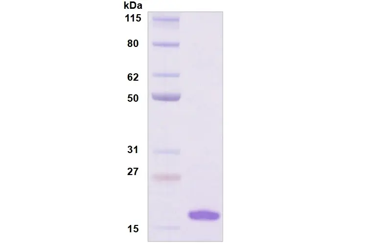 Recombinant Human Siglec-7, His Tag -100 ug